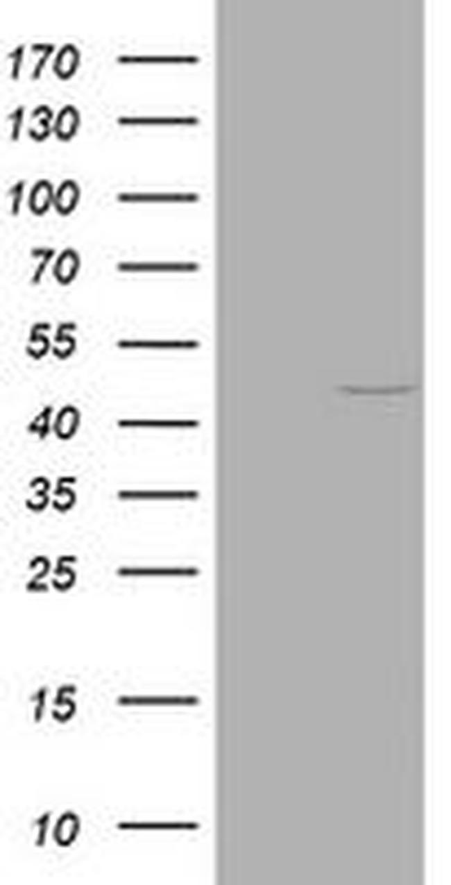 KRT20 Antibody in Western Blot (WB)
