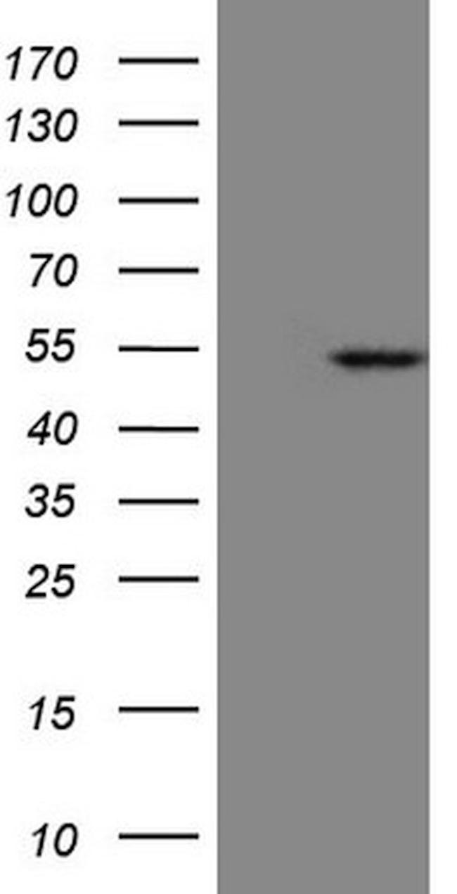 KRT23 Antibody in Western Blot (WB)