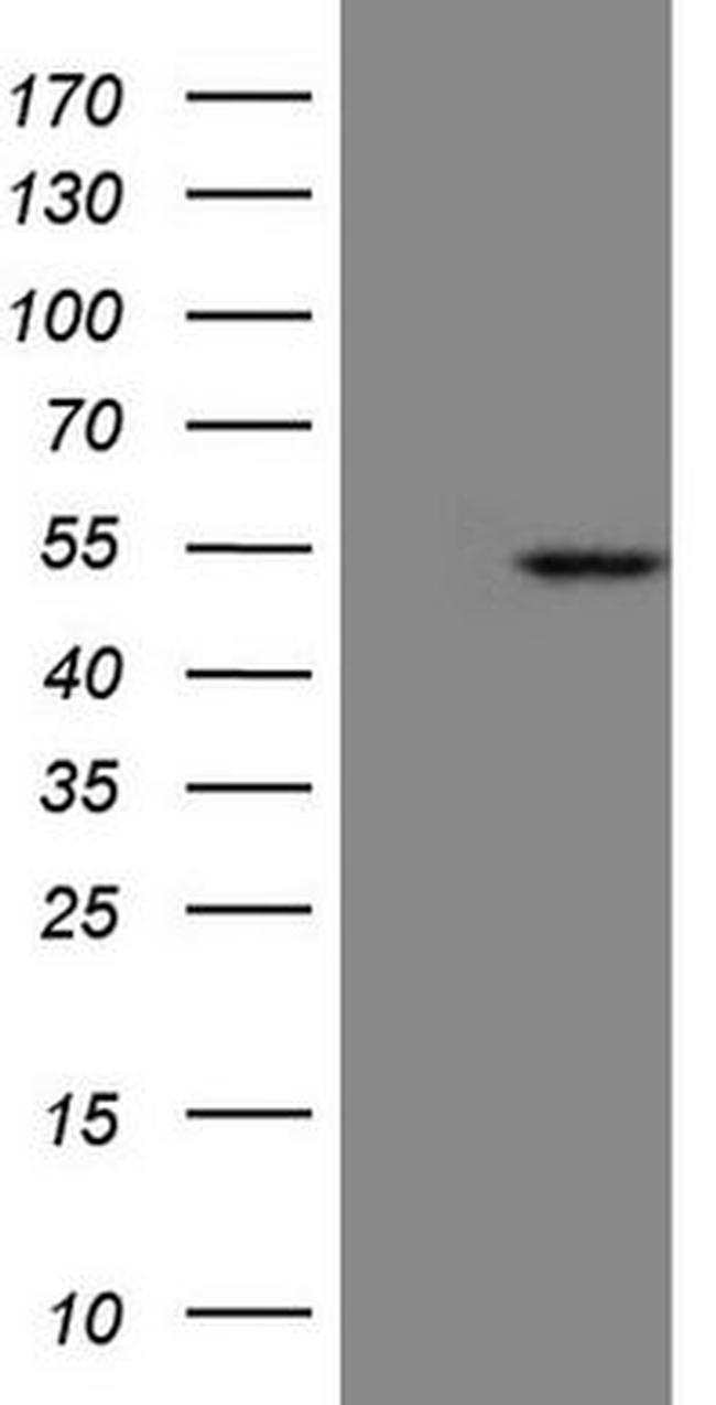 KRT23 Antibody in Western Blot (WB)