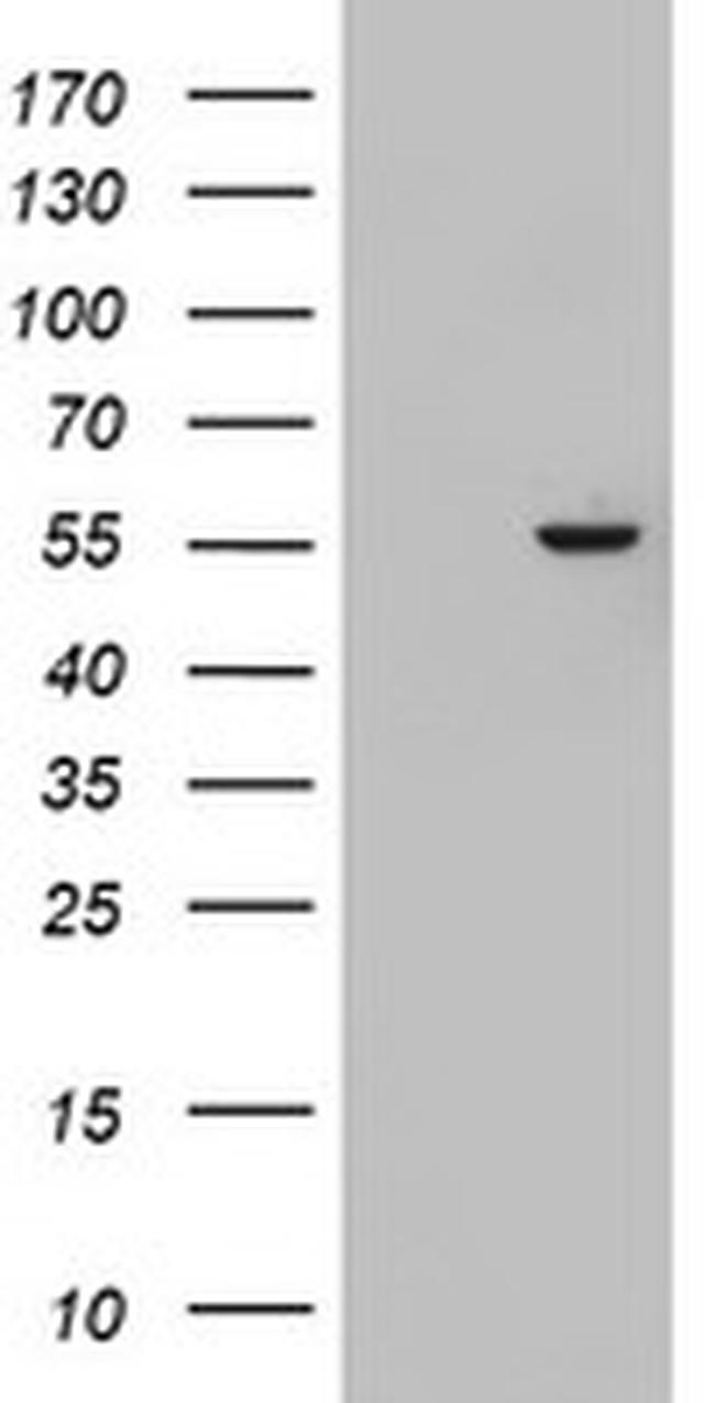 KRT24 Antibody in Western Blot (WB)