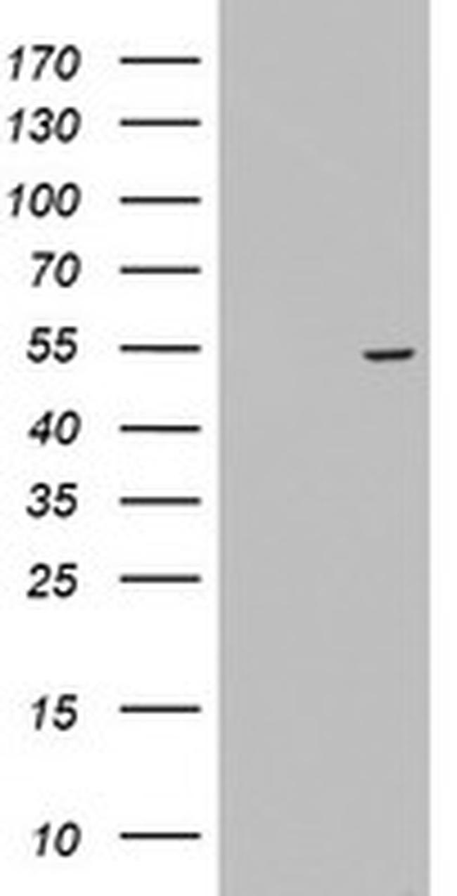 KRT24 Antibody in Western Blot (WB)