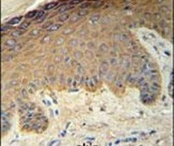Cytokeratin 35 Antibody in Immunohistochemistry (IHC)