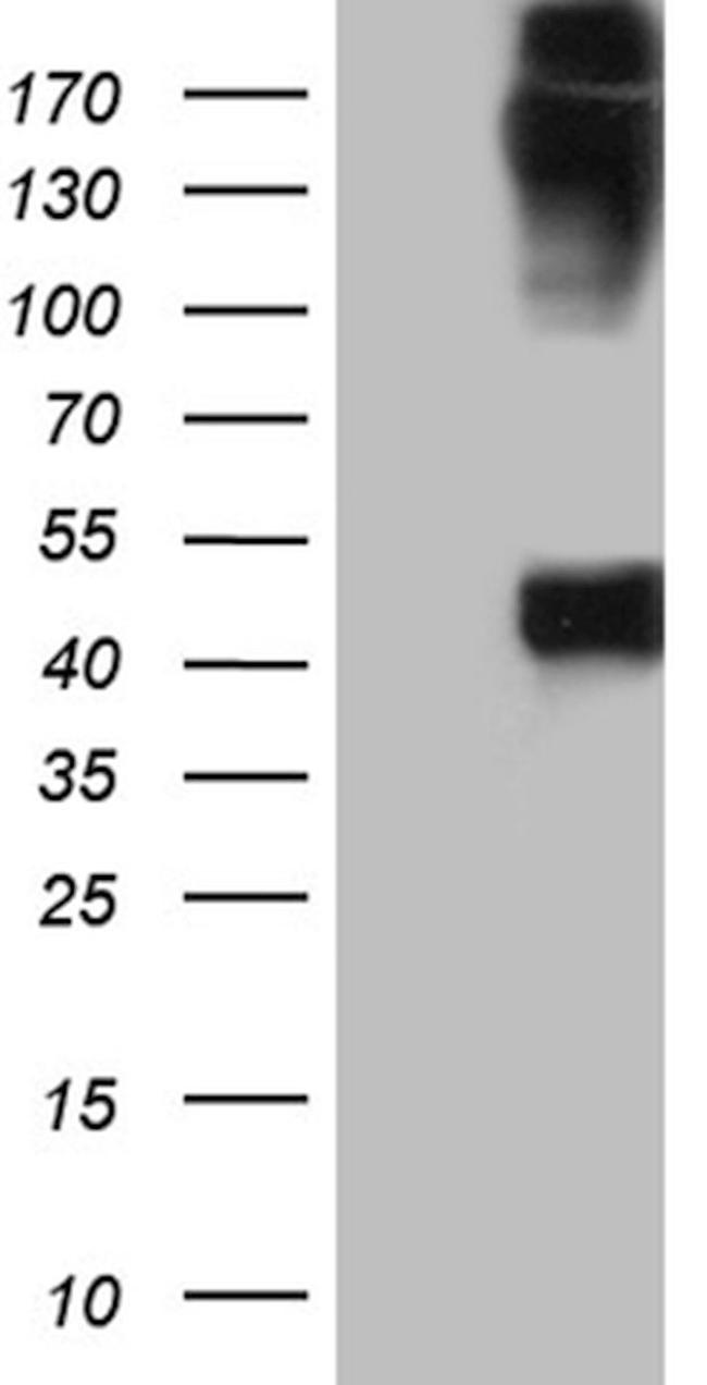 KRT35 Antibody in Western Blot (WB)