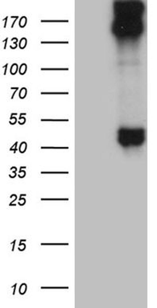 KRT35 Antibody in Western Blot (WB)