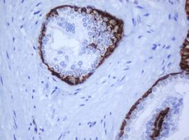KRT5 Antibody in Immunohistochemistry (Paraffin) (IHC (P))