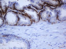 KRT5 Antibody in Immunohistochemistry (Paraffin) (IHC (P))