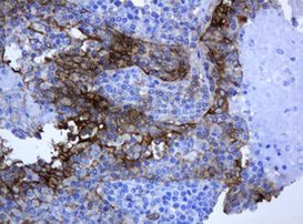 KRT5 Antibody in Immunohistochemistry (Paraffin) (IHC (P))