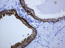 KRT5 Antibody in Immunohistochemistry (Paraffin) (IHC (P))