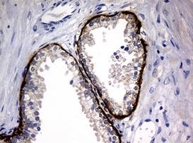 KRT5 Antibody in Immunohistochemistry (Paraffin) (IHC (P))