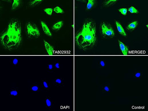 KRT7 Antibody in Immunocytochemistry (ICC/IF)