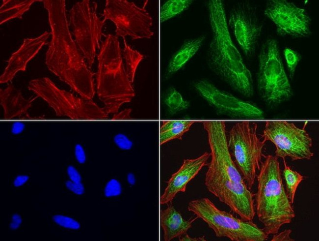 KRT7 Antibody in Immunocytochemistry (ICC/IF)