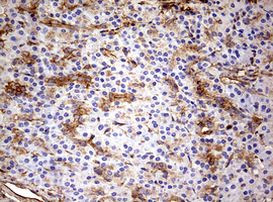 KRT7 Antibody in Immunohistochemistry (Paraffin) (IHC (P))