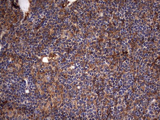 KRT7 Antibody in Immunohistochemistry (Paraffin) (IHC (P))