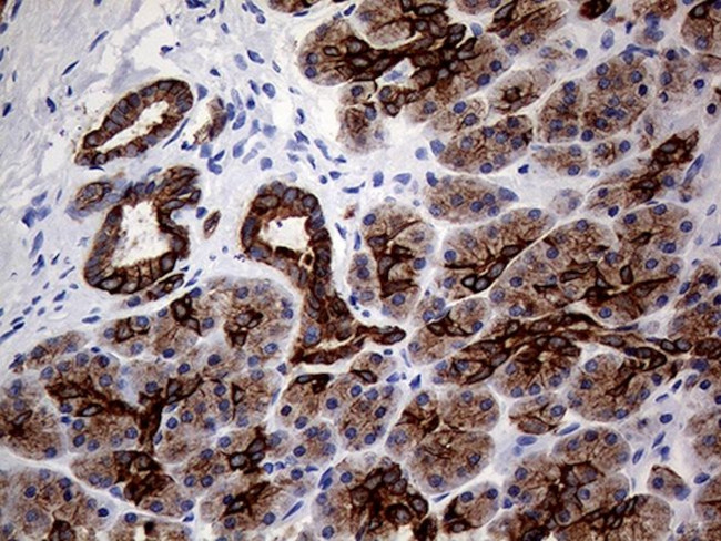 KRT8 Antibody in Immunohistochemistry (Paraffin) (IHC (P))