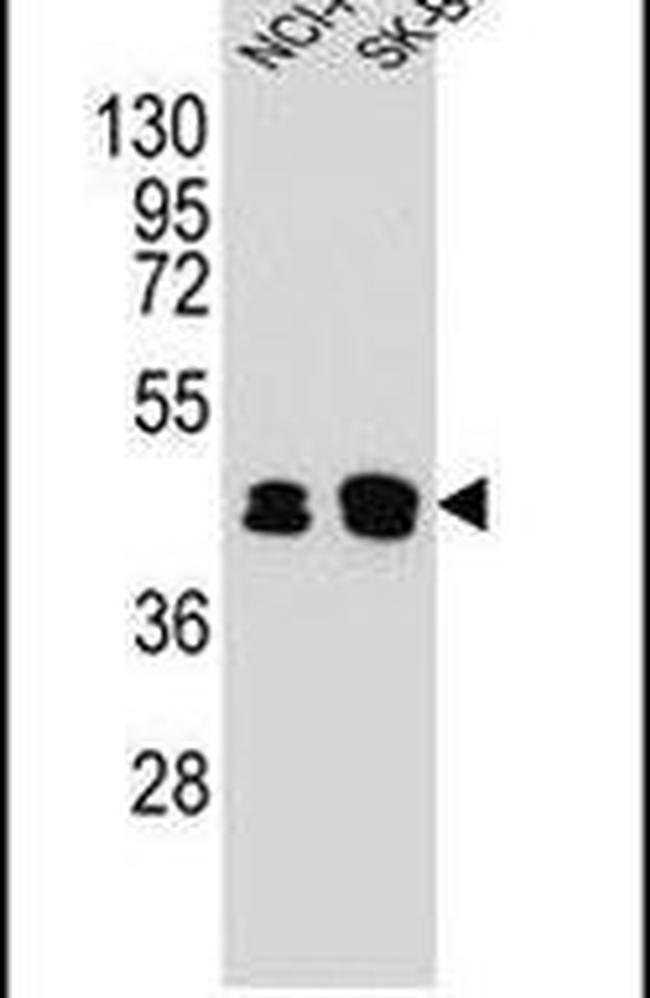 KRT80 Antibody in Western Blot (WB)
