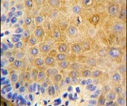 KRT9 Antibody in Immunohistochemistry (IHC)