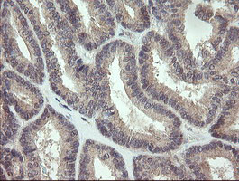 KRTAP2 Antibody in Immunohistochemistry (Paraffin) (IHC (P))