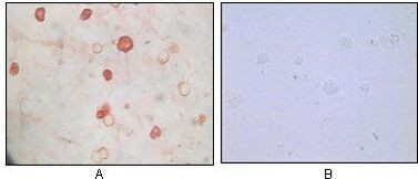 KSHV K8a Antibody in Immunocytochemistry (ICC/IF)