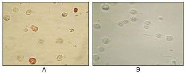 KSHV ORF45 Antibody in Immunocytochemistry (ICC/IF)