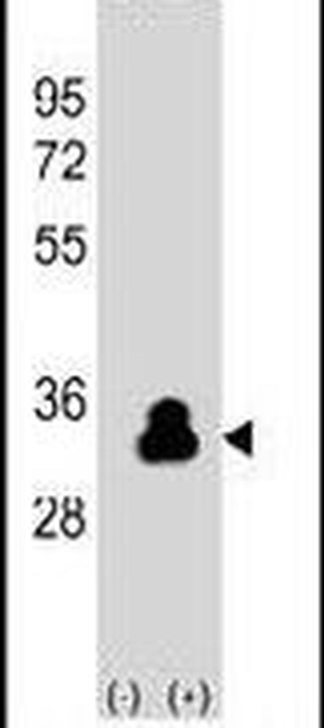 Kallikrein 4 Antibody in Western Blot (WB)