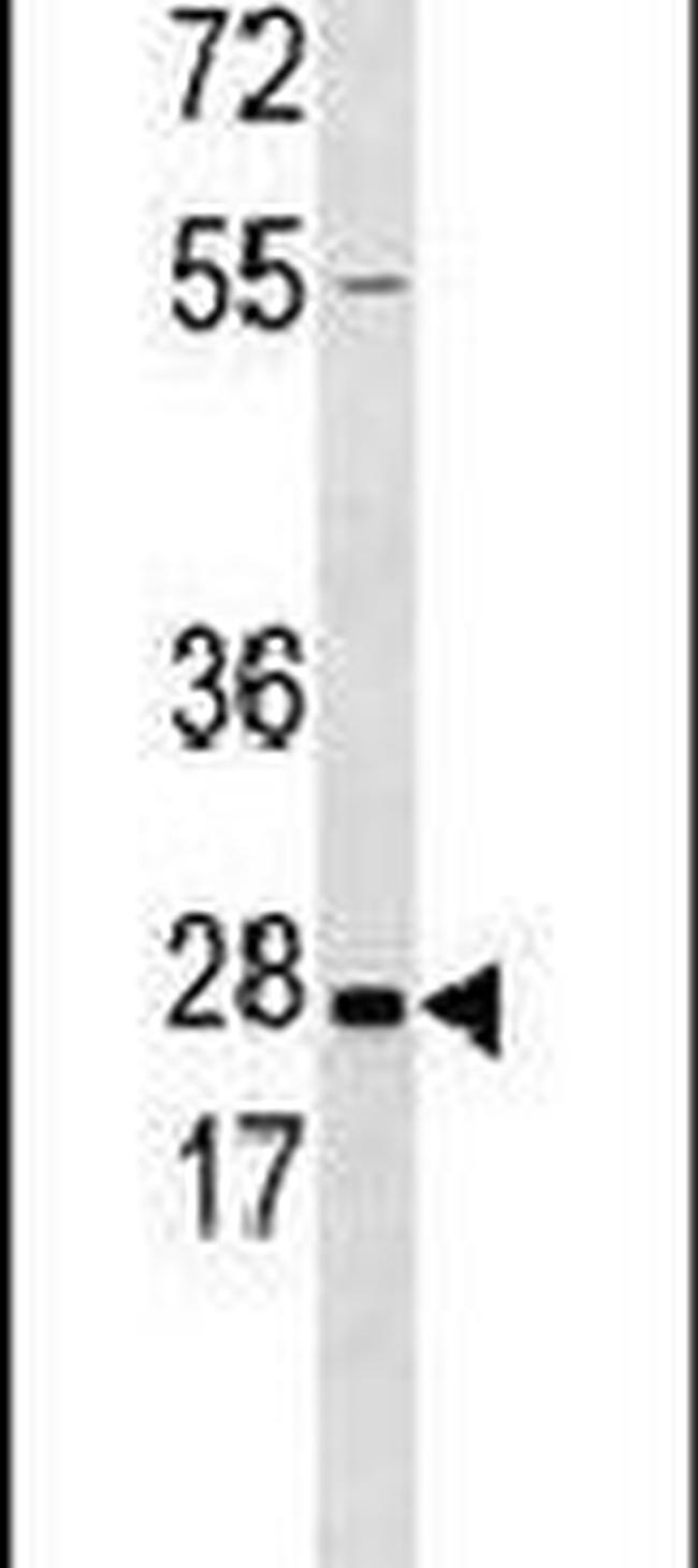 Kallikrein 5 Antibody in Western Blot (WB)