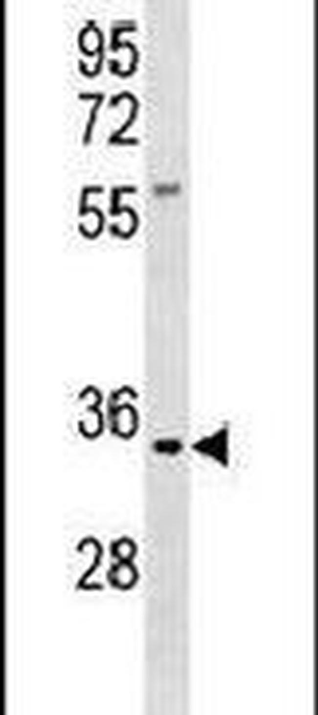 Kallikrein 9 Antibody in Western Blot (WB)