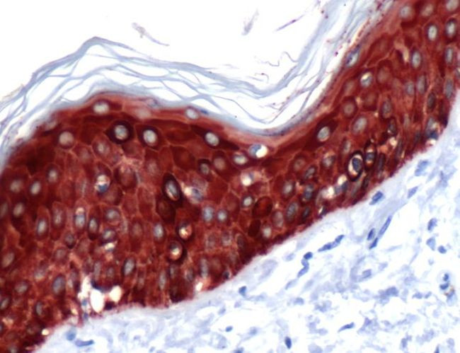 Cytokeratin 14 Antibody in Immunohistochemistry (IHC)
