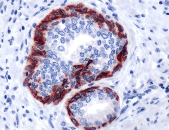 Cytokeratin 6 Antibody in Immunohistochemistry (Paraffin) (IHC (P))