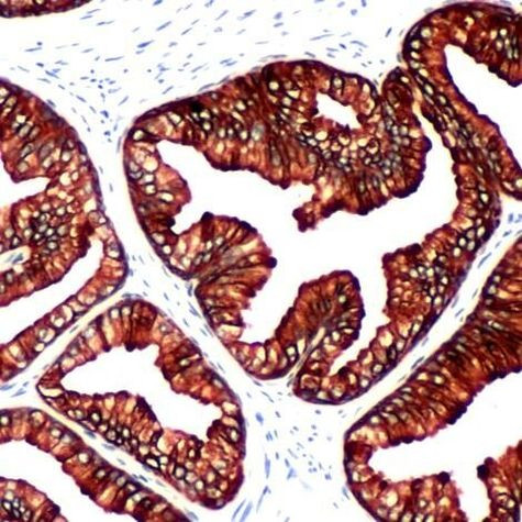 Cytokeratin 8 Antibody in Immunohistochemistry (IHC)