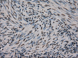 Ki67 Antibody in Immunohistochemistry (Paraffin) (IHC (P))