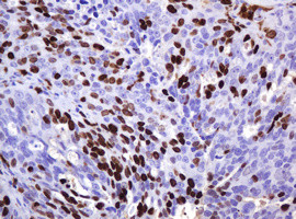 Ki67 Antibody in Immunohistochemistry (Paraffin) (IHC (P))