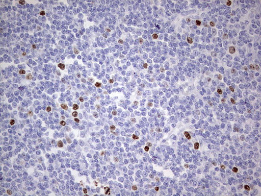 Ki67 Antibody in Immunohistochemistry (Paraffin) (IHC (P))