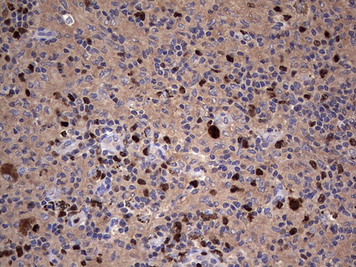 Ki67 Antibody in Immunohistochemistry (Paraffin) (IHC (P))