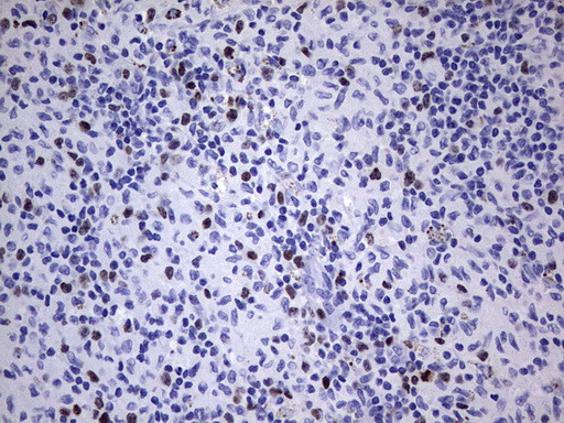 Ki67 Antibody in Immunohistochemistry (Paraffin) (IHC (P))