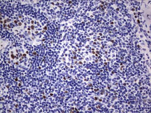 Ki67 Antibody in Immunohistochemistry (Paraffin) (IHC (P))