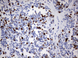 Ki67 Antibody in Immunohistochemistry (Paraffin) (IHC (P))