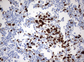 Ki67 Antibody in Immunohistochemistry (Paraffin) (IHC (P))