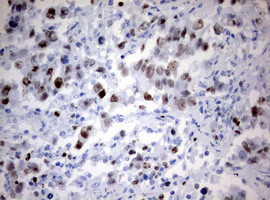 Ki67 Antibody in Immunohistochemistry (Paraffin) (IHC (P))