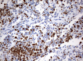 Ki67 Antibody in Immunohistochemistry (Paraffin) (IHC (P))