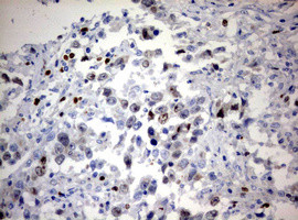 Ki67 Antibody in Immunohistochemistry (Paraffin) (IHC (P))