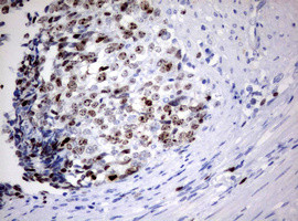 Ki67 Antibody in Immunohistochemistry (Paraffin) (IHC (P))