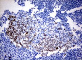 Ki67 Antibody in Immunohistochemistry (Paraffin) (IHC (P))
