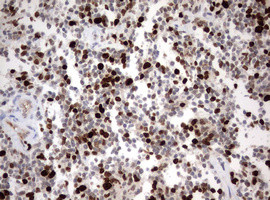 Ki67 Antibody in Immunohistochemistry (Paraffin) (IHC (P))