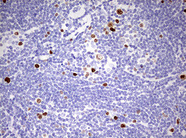 Ki67 Antibody in Immunohistochemistry (Paraffin) (IHC (P))
