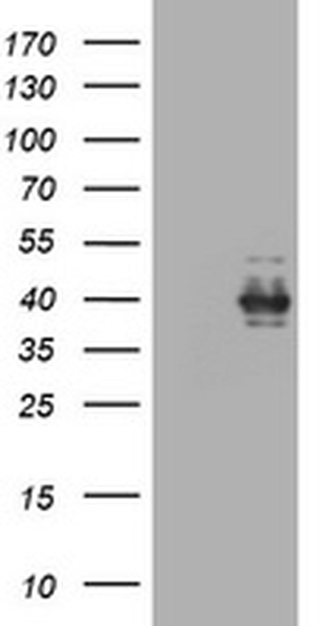 Ki67 Antibody in Western Blot (WB)