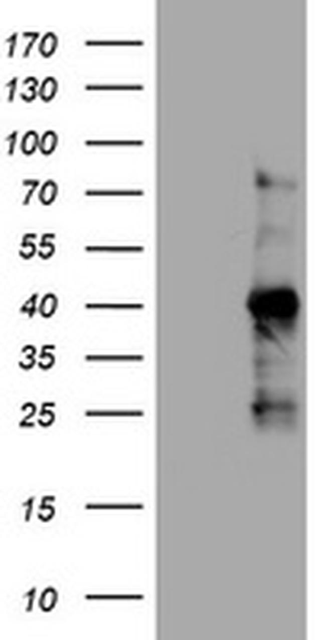 Ki67 Antibody in Western Blot (WB)