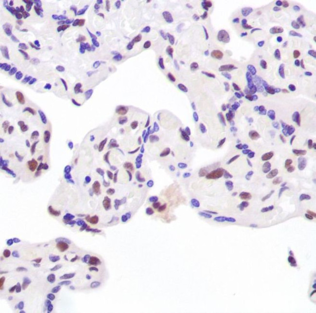 Ku80 Antibody in Immunohistochemistry (IHC)