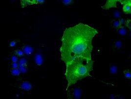 L1CAM Antibody in Immunocytochemistry (ICC/IF)