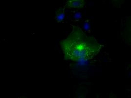 L1CAM Antibody in Immunocytochemistry (ICC/IF)