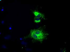 L1CAM Antibody in Immunocytochemistry (ICC/IF)